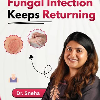 ✨ 5 सबसे बड़ी गलतियां जो Fungal Infection को और बढ़ा देती हैं… 😳

🎥 क्या आप भी त्वचा पर खुजली होते ह
