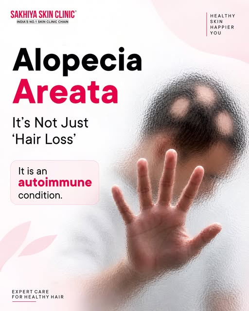 For many people, Alopecia Areata isn't just about losing hair - it's about losing confidence, answer