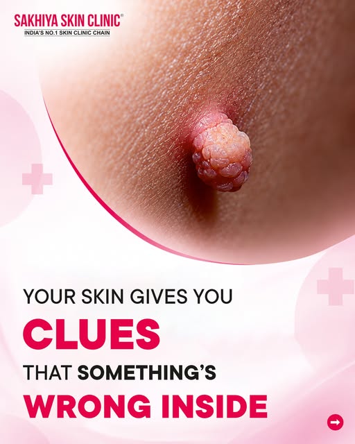 Your skin can reveal more than surface-level changes. Multiple skin tags have been associated with i