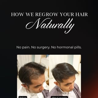 Regrow your hair naturally—with no pain, no surgery, and no hormonal pills.

Ooosh!™ uses gentle wee
