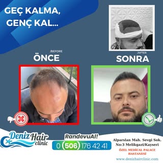 Saçlarınızı baştan çıkarıyoruz…
Sizde saç ekimi yaptırmak istiyorsanız bizimle iletişime geçebilirsi