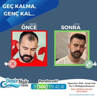 Saçlarınızı baştan çıkarıyoruz…
Sizde saç ekimi yaptırmak istiyorsanız bizimle iletişime geçebilirsi