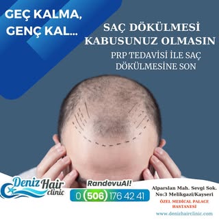 PRP Saç uygulaması sayesinde, zayıflamış ve incelmiş saçlar onarılır. Saç köklerinizi kalınlaştırır 