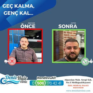 “Geç kalma, Genç Kal ” 🤗
.
.
Kliniğimize başvurarak size uygun uygulamayı doktorumuzla seçebilir