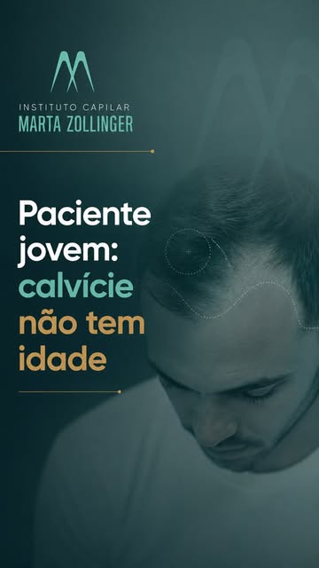 A calvície não espera a idade chegar.

É cada vez mais comum encontrar pacientes jovens que já apres