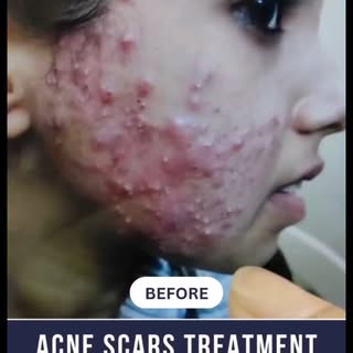 #BeforeAndAfter
#RealPeople #RealResults

🥰 Check out these incredible Before and After results of 