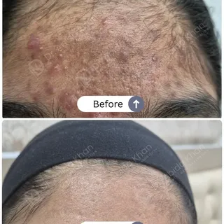 #BeforeAfter #RealPeople #RealResults

Hey, take a look 👀 — these visible Before & After results of