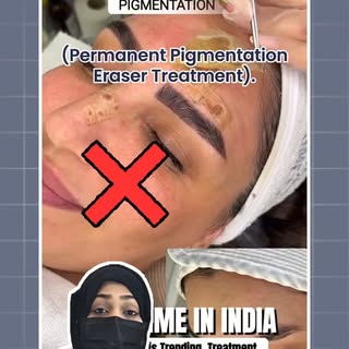 Permanent Pigmentation Eraser Treatment – Fact or Myth❓️

Have you come across viral videos claiming