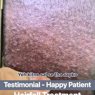#Testimonial #HappyPatient #HairFallTreatment

• Real People • Real Results • Real Confidence❗️

Hai