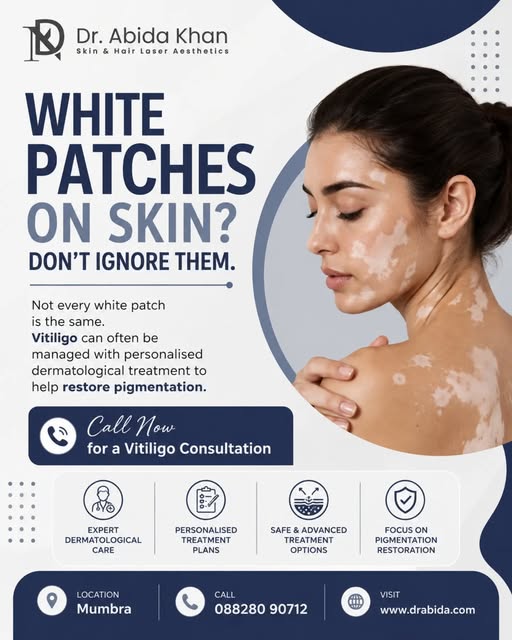 WHITE PATCHES ON SKIN❓️ DON’T IGNORE THEM.

Not every white patch is the same. While some may be cau