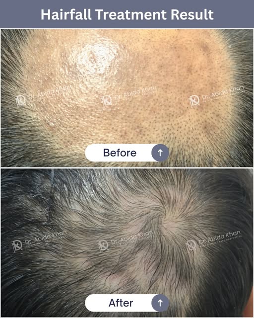 #BeforeAfter #RealPeople #RealResults

Hey, take a look 👀 — these visible Before & After results of