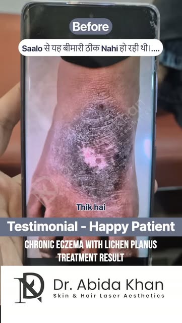 #Testimonial #HappyPatient #ChronicEczemaTreatment

• Real People • Real Results • Real Confidence❗️