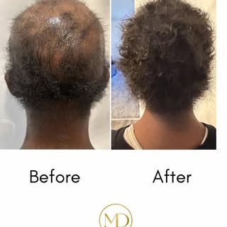 Hair restoration isn’t about finding the next miracle oil.

It’s about understanding what’s contribu