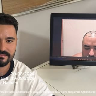 Görsel ,
Sağlık hizmetlerinde tanıtım ve bilgilendirme faaliyetleri hakkında yönetmeliğe uygun olara