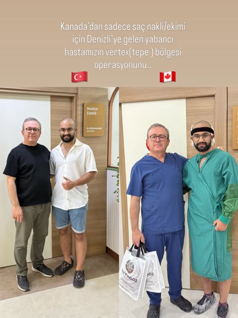 #hairtransplant #hairtransplanttürkiye #hairtransplantdenizli #hairtransplant#vizyongözhastanesisaçe