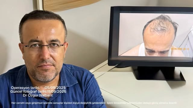 Görsel sağlık hizmetlerinde tanıtım ve bilgilendirme faaliyetleri hakkında yönetmeliğe uygun olarak 