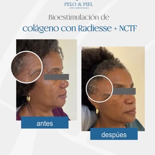 Este resultado nos llena de orgullo; a tan solo dos semanas de su tratamiento, nos refleja lo que po