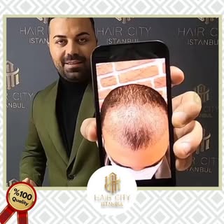 🌐Your hairs are dreaming meet  us.

For detaily information.Phone Number 📲+905448092575
 #haircity
