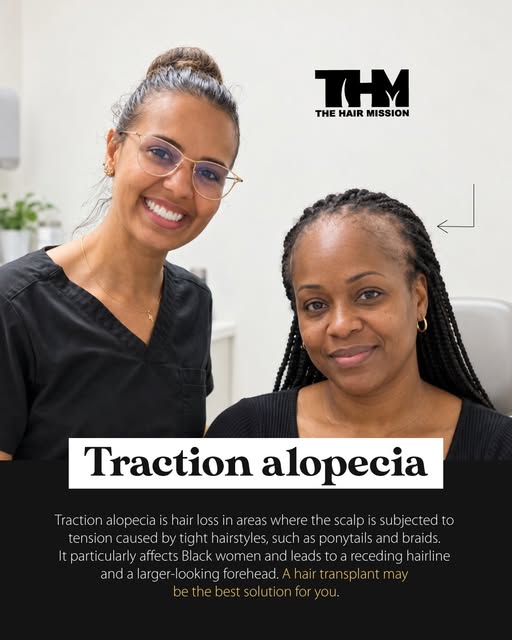✨ Understanding hair loss is the first step toward finding the right solution.

Traction alopecia ca