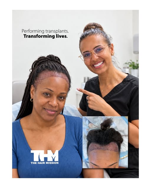 ✨ Confidence starts with feeling good about yourself.

At The Hair Mission, every hair transplant jo