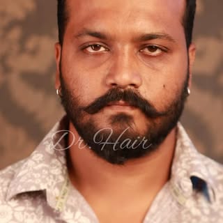Non Surgical Hair Replacement 
Contact us @ 9176545018
#viral #reels #viralreels #viralpost
