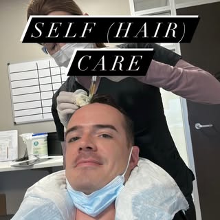 Medical adjuncts, including PRP, are critical for long term hair health with or without transplant a