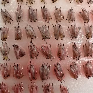 Why does the quality of your grafts matter so much?

I spend significant time staring under the scop