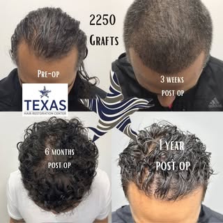 We love seeing the progress our patients get as they come in throughout the year! Our patient today 