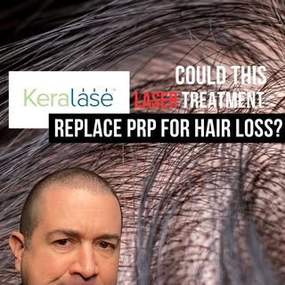 Keralase is great and in my opinion, a better alternative to PRP. Using biomimetic growth factors we