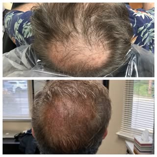 It’s so important to show realistic expectations when your a SMP provider. This client wanted to kee