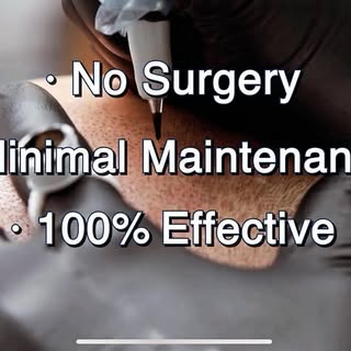 Is hair loss effecting your confidence? FINALLY a simple and safe solution with scalp micropigmentat