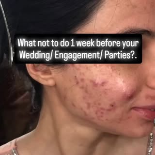 Instagram post