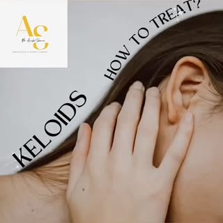 KELOIDS
CAN 
BE
TREATED, 

SAY BYE TO THE PAIN AND ITCH!

🤙 9041139176 
FOR TREATMENT OPTIONS.

A k