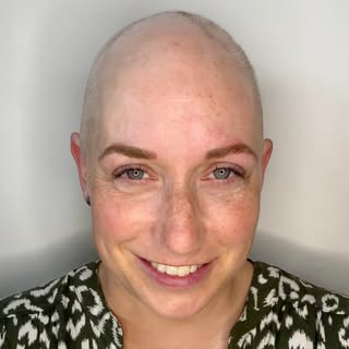 As someone who also navigates life with alopecia, this transformation meant the absolute world to me