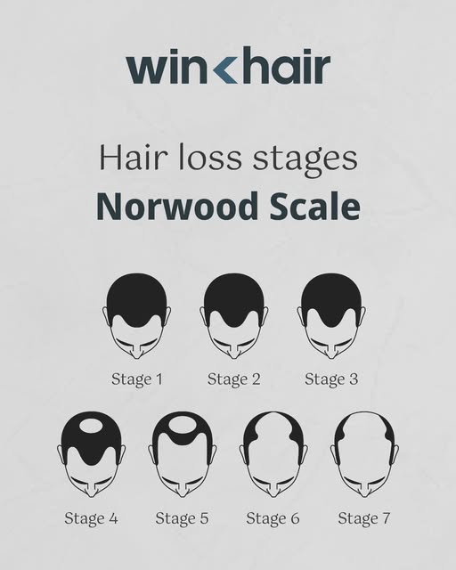 Are you identified with any stage? Don't worry, at Winhair we have the solution.

Get your questions