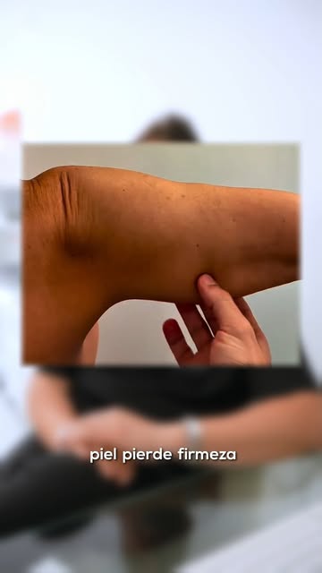 Si al mover el brazo notas que algo ha cambiado, este vídeo te interesa.⁣⁣
⁣⁣
No siempre es cuestión