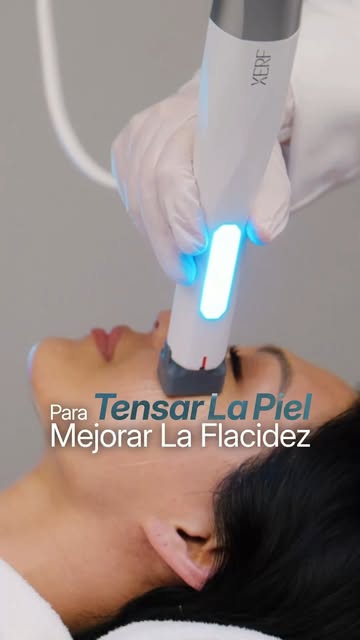 XERF YA ESTÁ EN CLÍNICAS DR. GUIDI. ✨⁣
⁣
Presentamos XERF, una tecnología avanzada que incorporamos 