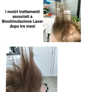 Quando la tua Mission impossible ....non è poi così impossibile 
Tre mesi di trattamenti e Biostimol