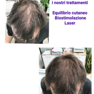 Le nostre vittorie, programma personalizzato di Trattamenti e Biostimolazione Laser.... CLIENTE SODD