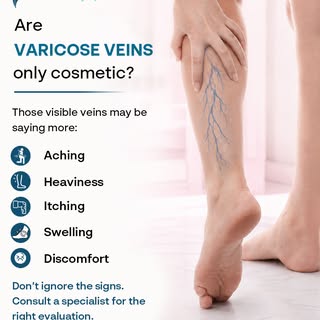 Do your legs feel heavy, achy, itchy, or swollen? These could be more than everyday fatigue—they may