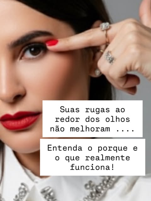 Entender o mecanismo de formação das linhas de expressão ao redor dos olhos é essencial para alinhar