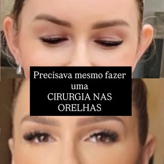 Quando pensamos em harmonia facial, é comum focar no olhar ou no sorriso. Mas você ja reparou no imp