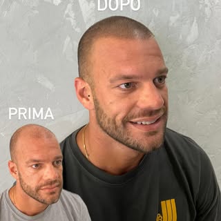 Quando un semplice trattamento estetico ti ridona il sorriso davanti allo specchio 💫 

#tricopigmen