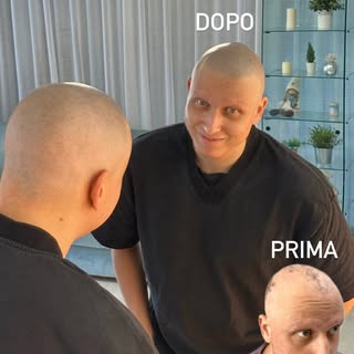 Da oggi, niente più cappellini. ❤️

È arrivato da noi con un’alopecia universale, abituato a nascond