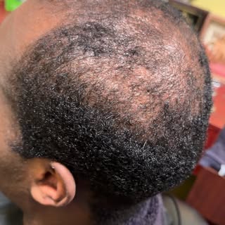 Mid 20’s and thinning????? This new client was getting the fiber hair technique, and just needed som