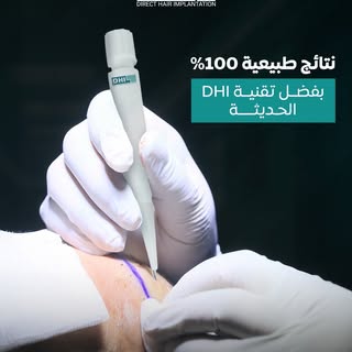 عندما تفشل جميع الحلول… تبقى تقنية DHI هي الحل الأمثل لاستعادة شعرك
✔ زراعة مباشرة للشعر دون تدخل جر