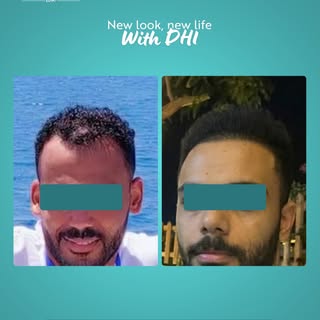 .
New Look, New Life 
 where every graft creates a new beginning..

Book your consultation now:
📞 I