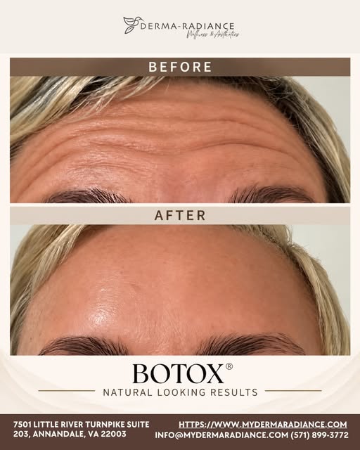 Smooth, refreshed, and still you. ✨

This before-and-after shows the power of a thoughtfully customi