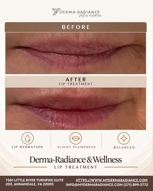 Subtle changes. Beautiful impact. ✨

This lip treatment was all about enhancing what was already the