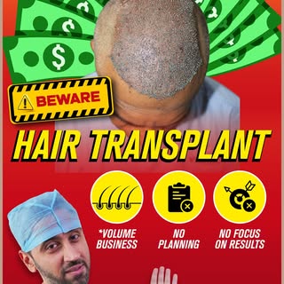 Hair transplant has become a volume business | No Planning | No Focus on results

One of the biggest
